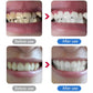 💎Surprise Price ￡9.99!!🦷✨Electric Ultrasonic Dental Scaler for Tartar and Plaque Removal