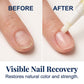 7-Piece Pen & File Set for Discolored Nails